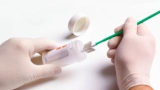 Δωρεάν προληπτικό HPV test στα χωριά Φυλάκιο και Βάλτο