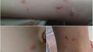Έξαρση από ψύλλους σε πολλές περιοχές της Σαμοθράκης