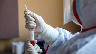 310 τα νέα κρούσματα στην Ελλάδα - Μόνο ένα νέο κρούσμα ο Έβρος