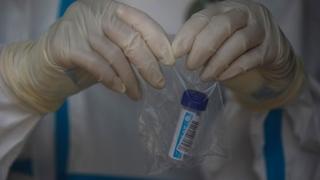 ΕΟΔΥ: 204 νέα κρούσματα κορονοϊού στην χώρα - 5 στον Έβρο