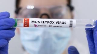 Ευλογιά των πιθήκων: Ανοίγει εμβολιαστικό κέντρο και στην Αλεξανδρούπολη