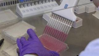 Έβρος: Ενημερωτικές εκδηλώσεις για τον ιό έμπολα.