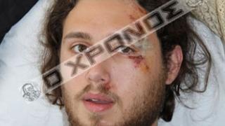 Στη δικαιοσύνη οι δράστες του ξυλοδαρμού στην Κομοτηνή.