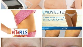 Vita Plus Αλεξανδρούπολης: Νέα τεχνολογία Exilis διαμόρφωσης σώματος και αντιγήρανσης προσώπου