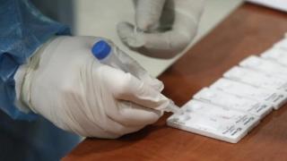«Stop» στα rapid tests από τα φαρμακεία ζητούν οι Iατρικοί Σύλλογοι της ΑΜΘ