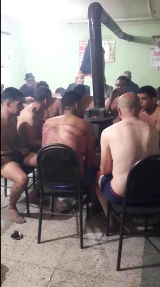 Τα σημαδεμένα σώματα των ανθρώπων μαρτυρούν την αγριότητα της επίθεσης 