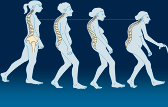 Μία στις τρεις Ελληνίδες, νεότερες των 50 ετών, θα εμφανίσει οστεοπόρωση.