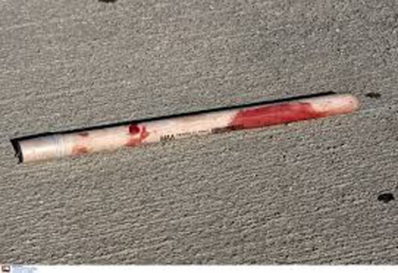 Άγριος ξυλοδαρμός με γκλομπς στην Αλεξανδρούπολη 